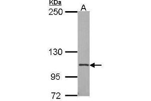 WB Image Sample (30 ug of whole cell lysate) A: A549 7. (Integrin Alpha2b antibody  (Internal Region))