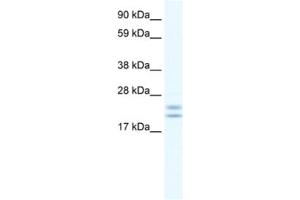 Western Blotting (WB) image for anti-Tubulin Polymerization Promoting Protein (Tppp) antibody (ABIN2461556) (Tppp antibody)