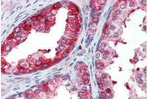 Anti-SKP2 antibody IHC staining of human prostate. (SKP2 antibody  (AA 221-425))
