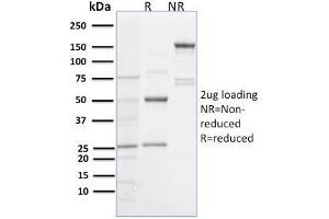 SDS-PAGE Analysis Purified Spastin Mouse Monoclonal Antibody (Sp 6C6). (Spastin antibody)