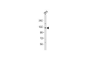 Anti-stk10 Antibody (Center)at 1:2000 dilution + ZF4 whole cell lysates Lysates/proteins at 20 μg per lane. (STK10-A antibody  (AA 342-376))