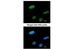 ICC/IF Image Immunofluorescence analysis of paraformaldehyde-fixed HeLa, using RASSF1, antibody at 1:100 dilution. (RASSF1 antibody  (Center))