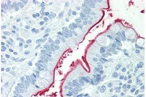 NPC1L1 antibody  (Internal Region)
