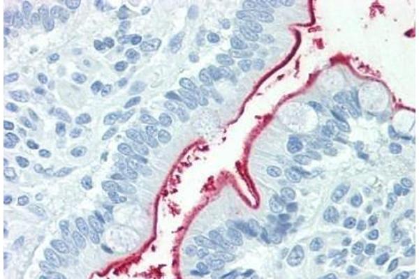 NPC1L1 antibody  (Internal Region)