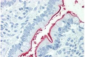 Human Small Intestine: Formalin-Fixed, Paraffin-Embedded (FFPE) (NPC1L1 antibody  (Internal Region))