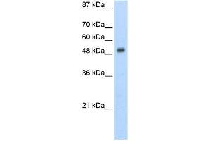 WB Suggested Anti-DES Antibody Titration:  5. (Desmin antibody  (N-Term))