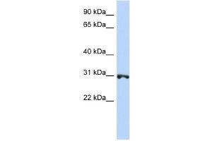RNF126 antibody used at 1 ug/ml to detect target protein. (RNF126 antibody  (N-Term))
