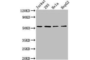 Western Blot Positive WB detected in: Jurkat whole cell lysate, 293 whole cell lysate, Hela whole cell lysate, HepG2 whole cell lysate All lanes: SLC16A12 antibody at 3 μg/mL Secondary Goat polyclonal to rabbit IgG at 1/50000 dilution Predicted band size: 54 kDa Observed band size: 54 kDa (SLC16A12 antibody  (AA 431-486))