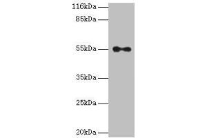 Western blot All lanes: THRA antibody at 2 μg/mL + A431 whole cell lysate Secondary Goat polyclonal to rabbit IgG at 1/10000 dilution Predicted band size: 55, 47, 51 kDa Observed band size: 55 kDa (THRA antibody  (AA 1-490))