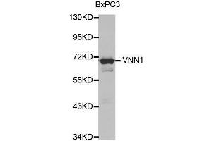 Western blot analysis of extracts of various cell lines, using VNN1 antibody. (VNN1 antibody  (AA 300-415))