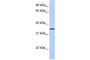 Western Blotting (WB) image for anti-CDC42 Effector Protein (Rho GTPase Binding) 4 (CDC42EP4) antibody (ABIN2459819) (CDC42EP4 antibody)