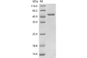Chitinase Domain Containing 1 (CHID1) (AA 20-393), (full length) protein (His tag)