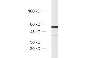 dilution: 1 : 1000, sample: rat brain homogenate (TUBB3 antibody)