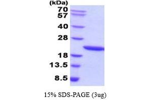 SDS-PAGE (SDS) image for Growth Hormone 1 (GH1) protein (ABIN666679) (Growth Hormone 1 Protein (GH1))