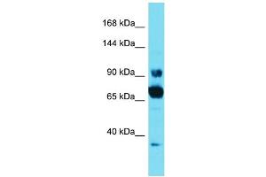 Host: Rabbit Target Name: CCDC178 Sample Type: HT1080 Whole Cell lysates Antibody Dilution: 1. (CCDC178 antibody  (C-Term))