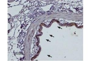 Expression of α2B-Adrenoreceptor in rat lungImmunohistochemical staining of rat lung paraffin embedded sections using Anti-α2B-Adrenergic Receptor (extracellular) Antibody (ABIN7042900, ABIN7043920 and ABIN7043921), (1:100). (Adrenergic, alpha-2B-, Receptor (ADRA2B) Peptide)
