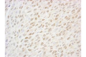 Immunohistochemistry (IHC) image for anti-SSB1 (AA 161-211) antibody (ABIN7448816) (SSB1 (AA 161-211) antibody)