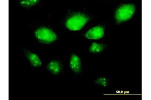 Immunofluorescence of purified MaxPab antibody to HSPA2 on HeLa cell. (HSPA2 antibody  (AA 1-639))