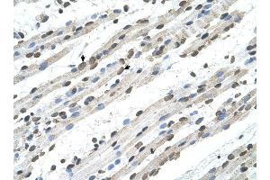 RCE1 antibody was used for immunohistochemistry at a concentration of 4-8 ug/ml to stain Skeletal muscle cells (arrows) in Human Muscle. (RCE1/FACE2 antibody)