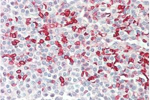 ABIN5539536 (5µg/ml) staining of paraffin embedded Human Spleen. (HMBS antibody  (AA 160-173))