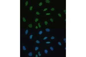 Immunofluorescence analysis of U-2 OS cells using MKL1 Polyclonal Antibody  at dilution of 1:100 (40x lens).