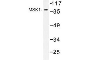 Image no. 1 for anti-Ribosomal Protein S6 Kinase, 90kDa, Polypeptide 5 (RPS6KA5) antibody (ABIN317778) (MSK1 antibody)
