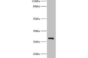 Western blot All lanes: HSD17B14 antibody at 2 μg/mL + Mouse kidney tissue Secondary Goat polyclonal to rabbit IgG at 1/10000 dilution Predicted band size: 29 kDa Observed band size: 29 kDa (HSD17B14 antibody  (AA 1-270))