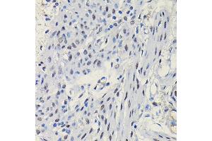 Immunohistochemistry of paraffin-embedded mouse uterus using Progesterone Receptor Rabbit pAb (ABIN6128570, ABIN6145518, ABIN6145519 and ABIN6213802) at dilution of 1:100 (40x lens). (Progesterone Receptor antibody  (AA 1-250))