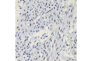 Immunohistochemistry of paraffin-embedded mouse uterus using Progesterone Receptor Rabbit pAb (ABIN6128570, ABIN6145518, ABIN6145519 and ABIN6213802) at dilution of 1:100 (40x lens).