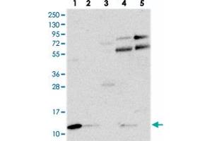 Western blot analysis of Lane 1: RT-4, Lane 2: U-251 MG, Lane 3: Human Plasma, Lane 4: Liver, Lane 5: Tonsil with C18orf32 polyclonal antibody  at 1:250-1:500 dilution. (C18orf32 antibody)