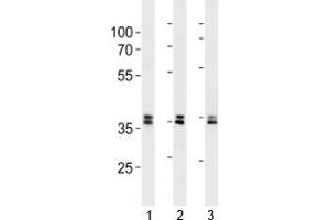 UCH37 antibody western blot analysis in 293, HeLa, 293T lysate. (UCHL5 antibody)