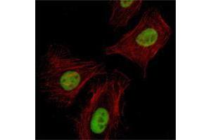 Immunofluorescence analysis of Hela cells using Pirh2 mouse mAb (green). (RCHY1 antibody)