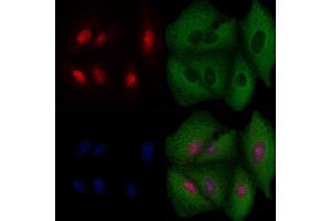 ABIN6256973 and ABIN6274518 staining  cells by IF/ICC. (BRMS1 antibody  (N-Term))