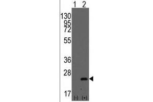 Western blot analysis of BarX1(arrow) using rabbit polyclonal BarX1 Antibody (C-term) .