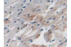 Detection of DLD in Rat Heart Tissue using Polyclonal Antibody to Dihydrolipoyl Dehydrogenase (DLD)