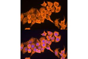 Immunofluorescence analysis of HeLa cells using RPL23 antibody (ABIN1682575, ABIN5664722, ABIN5664724 and ABIN6220574) at dilution of 1:100. (RPL23 antibody  (AA 1-140))