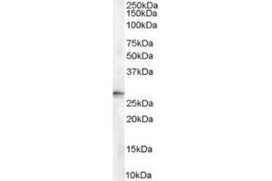 Image no. 2 for anti-Stratifin (SFN) (Internal Region), (N-Term) antibody (ABIN374638) (14-3-3 sigma/SFN antibody  (Internal Region, N-Term))