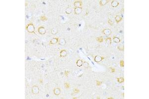 Immunohistochemistry of paraffin-embedded rat brain using Casp8 antibody (ABIN5997368) at dilution of 1/100 (40x lens). (Caspase 8 antibody)