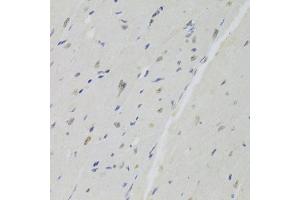 Immunohistochemistry (IHC) image for anti-Docking Protein 1, 62kDa (Downstream of tyrosine Kinase 1) (DOK1) (AA 1-280) antibody (ABIN6139763)