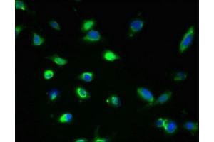 Immunofluorescent analysis of U251 cells using ABIN7154172 at dilution of 1:100 and Alexa Fluor 488-congugated AffiniPure Goat Anti-Rabbit IgG(H+L) (GDPD2 antibody  (AA 210-490))