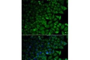 Immunofluorescence analysis of HeLa cells using CD1D Polyclonal Antibody (CD1d antibody)