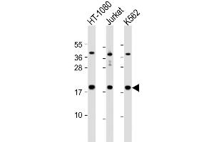 Western Blot at 1:1000 dilution Lane 1: HT-1080 whole cell lysate Lane 2: Jurkat whole cell lysate Lane 3: K562 whole cell lysate Lysates/proteins at 20 ug per lane. (NAA50 antibody  (C-Term))