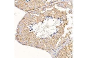 Immunohistochemistry of paraffin-embedded mouse testis using KRAS Rabbit pAb (ABIN3021676, ABIN3021677, ABIN3021678, ABIN1513137 and ABIN1514282) at dilution of 1:150 (40x lens). (K-RAS antibody)