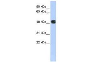 Image no. 1 for anti-Calcium Channel, Voltage-Dependent, beta 3 Subunit (CACNB3) (N-Term) antibody (ABIN6740406) (CACNB3 antibody  (N-Term))