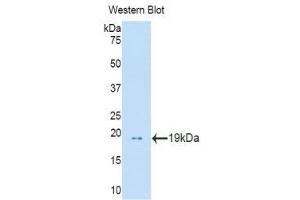 Western Blotting (WB) image for anti-Profilin 1 (PFN1) (AA 1-139) antibody (ABIN3205330) (PFN1 antibody  (AA 1-139))