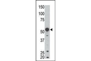 Western blot analysis of anti-BLK Pab (ABIN392087 and ABIN2841844) in mouse kidney tissue lysate. (BLK antibody  (N-Term))