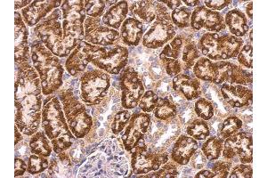IHC-P Image ABAT antibody detects ABAT protein at mitochondria on mouse kidney by immunohistochemical analysis. (ABAT antibody)