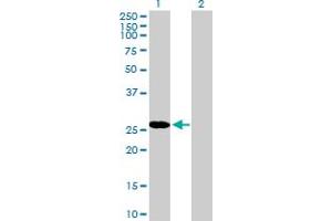 Western Blot analysis of RBPMS expression in transfected 293T cell line by RBPMS MaxPab polyclonal antibody. (RBPMS antibody  (AA 1-219))