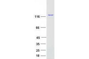 Validation with Western Blot (SART3 Protein (Myc-DYKDDDDK Tag))