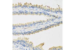 Immunohistochemistry of paraffin-embedded human prostate using LEP antibody at dilution of 1:100 (40x lens).